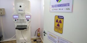 Cirurgias plásticas de mama no SUS crescem 54% em dez anos até 2025