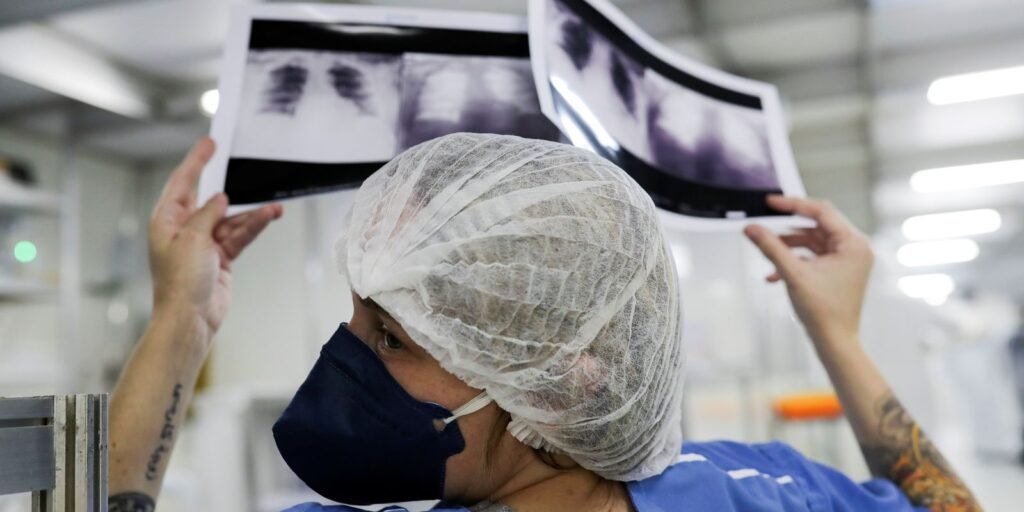 Diagnóstico tardio compromete chances de cura do câncer de pulmão no Brasil