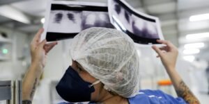 Diagnóstico tardio compromete chances de cura do câncer de pulmão no Brasil