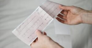 Síndrome da morte súbita em adultos: o que médicos precisam saber para comunicar