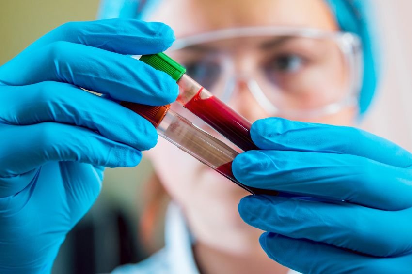 Einstein adota biópsia líquida multicâncer para detecção precoce no Brasil